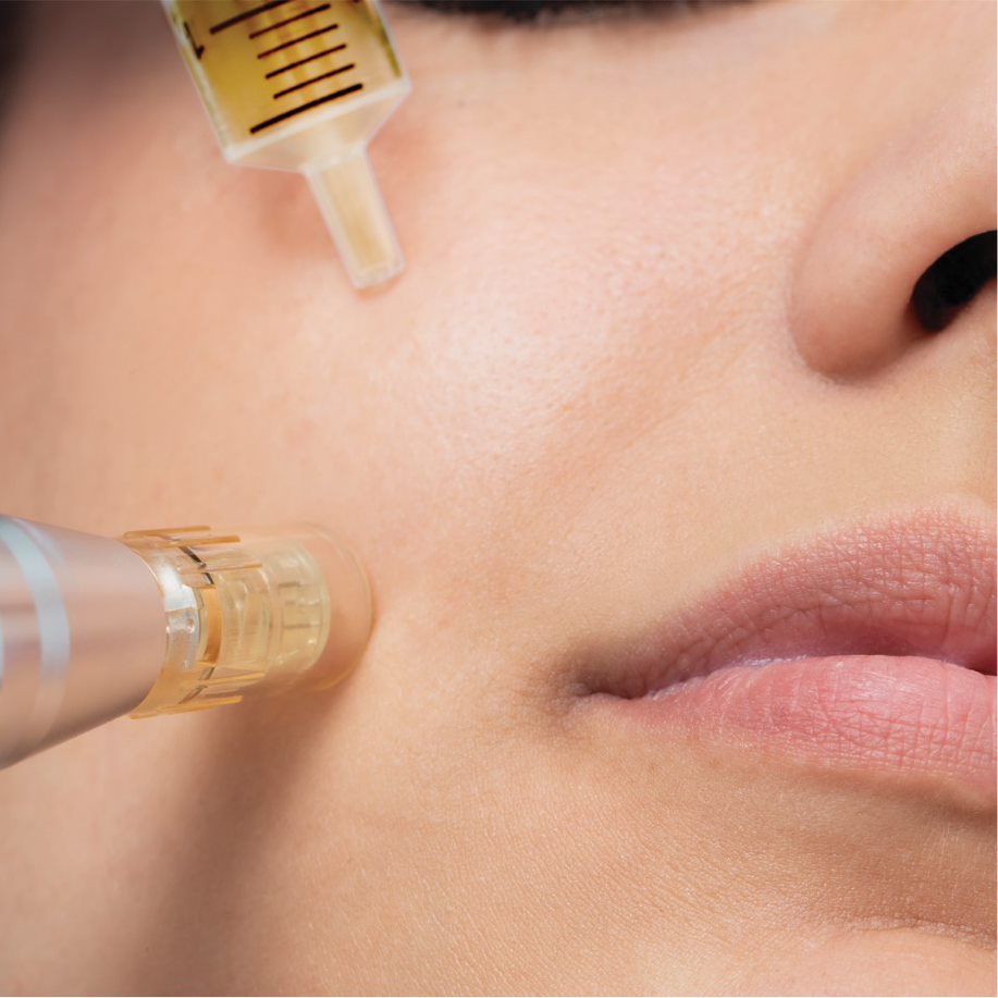 skin mesotherapy