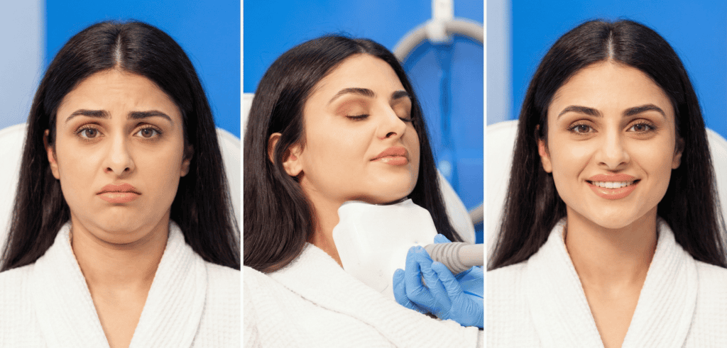 double reduction treatment