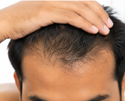 Why Are You Losing Hair